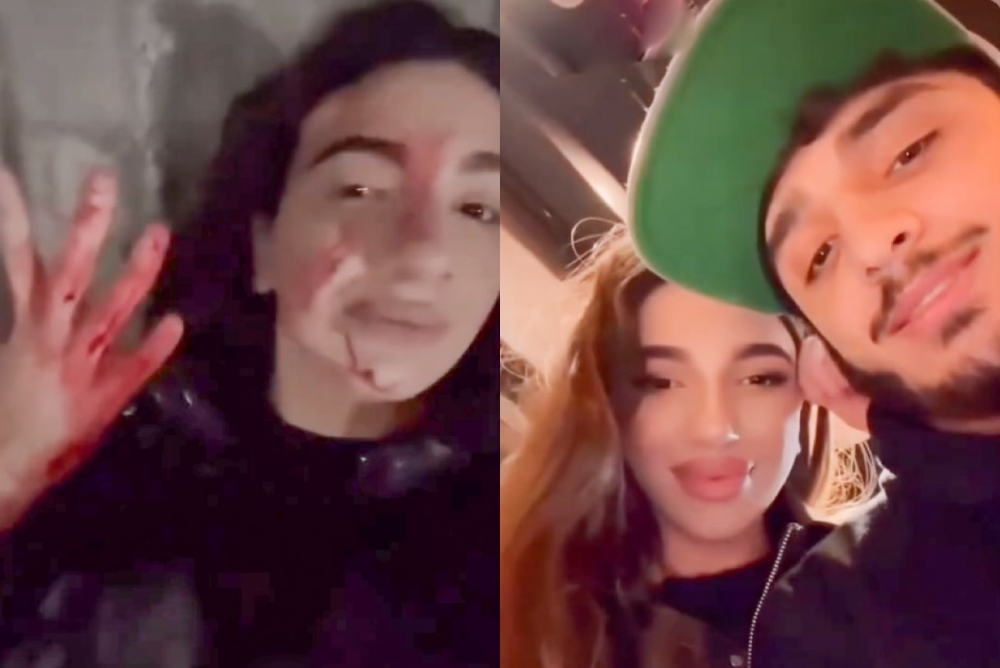 Xanım idmançı sevgilisi tərəfindən döyüldüyünü iddia edib
