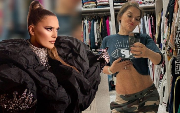 11 kiloqram arıqladığını belə nümayiş etdi - Foto
