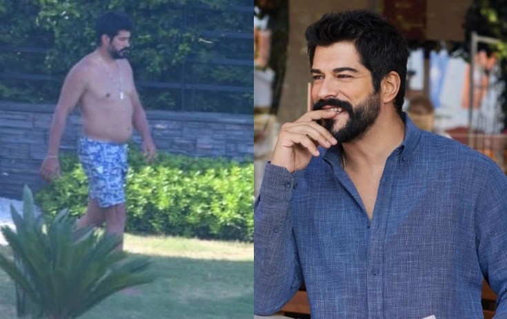 Burak Özçivit kökəlib bu hala düşdü - Fotolar