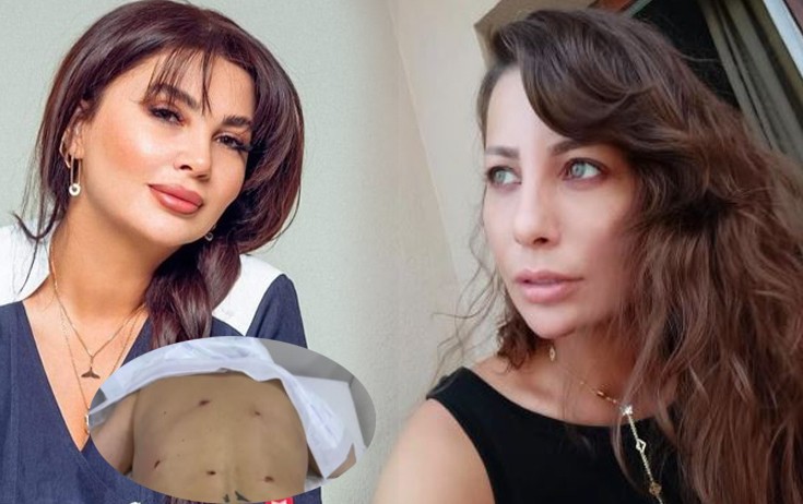 "Ülviyyə İlyasova məni uğursuz əməliyyat edib, indi də hədələyir"