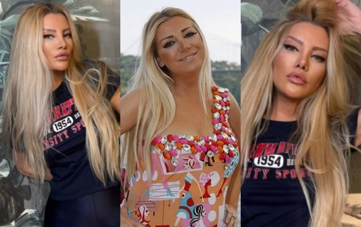Gülşah Saraçoğlu 9 saatlıq estetik əməliyyatdan sonra - Fotolar