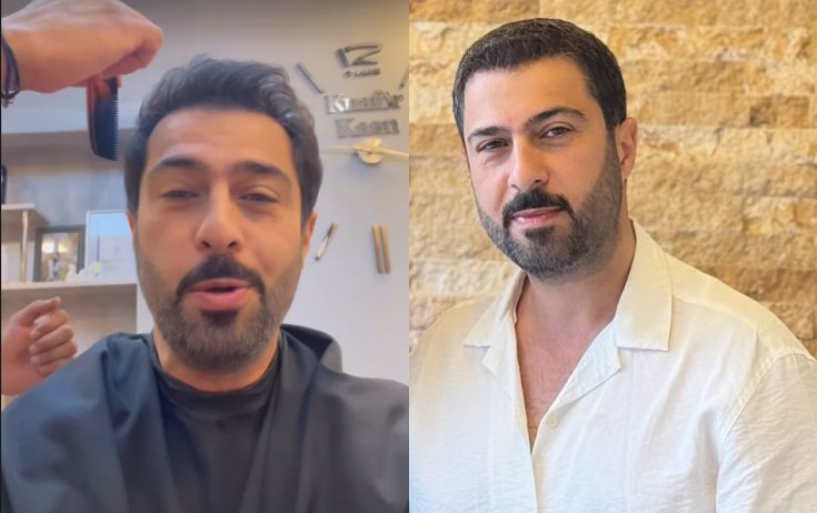 Namiqin saçı parikdir?