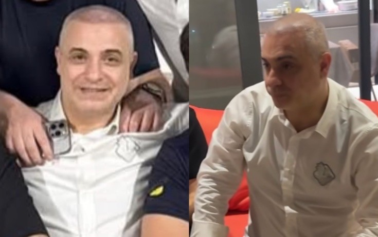 Rüfət Axundov saç əkdirib
