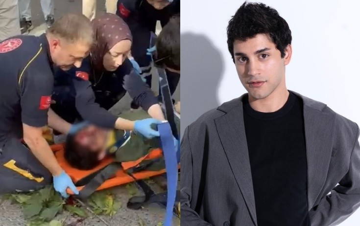 27 yaşlı aktyorun üstünə ağac aşdı, komaya düşdü