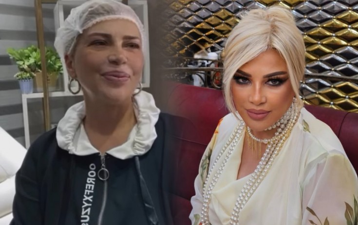 Mətanət İsgəndərlinin plastik əməliyyatdan sonrakı halı - Foto
