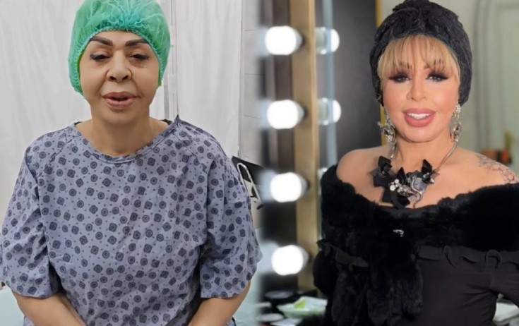 Ruhəngiz Allahverdiyeva plastik əməliyyat etdirdi