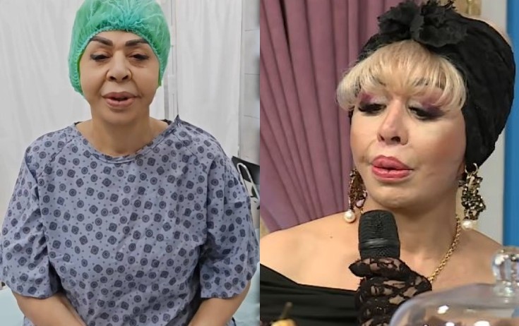 Ruhəngiz Allahverdiyeva plastik əməliyyatdan sonra - Foto