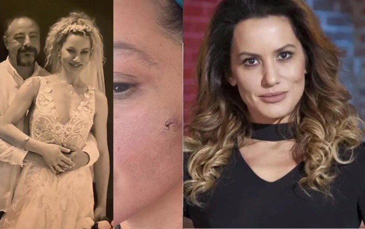 Yıldız Asyalı həyat yoldaşı tərəfindən döyüldüyünü açıqladı - Fotolar