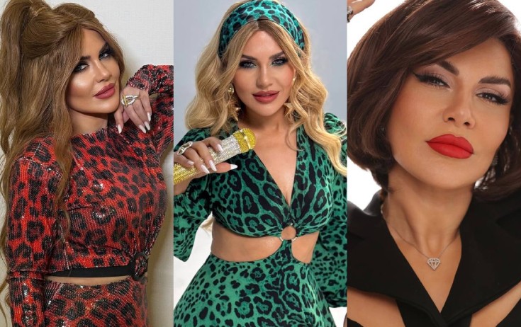 Öz saçı olmadığını etiraf etdi - Fotolar