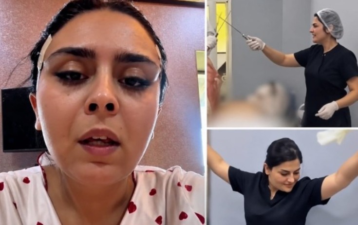 Daha bir nəfər rəqs edən həkimin qurbanı oldu - Video